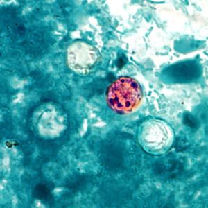 Image of Cyclospora cayetanensis. which causes cyclosporiasis.