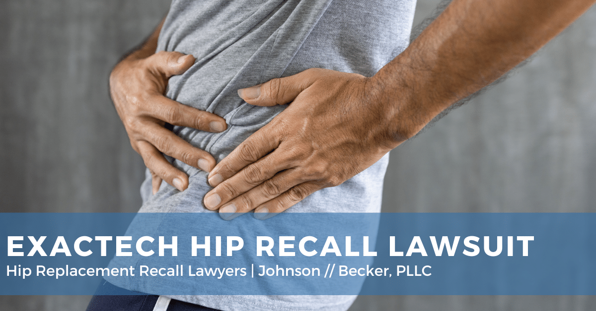 Johnson And Johnson Hip Replacement Lawsuit Exactech Hip Replacement Recall Lawsuit | Johnson//Becker